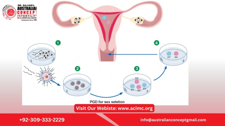 Can You Choose Gender with IVF